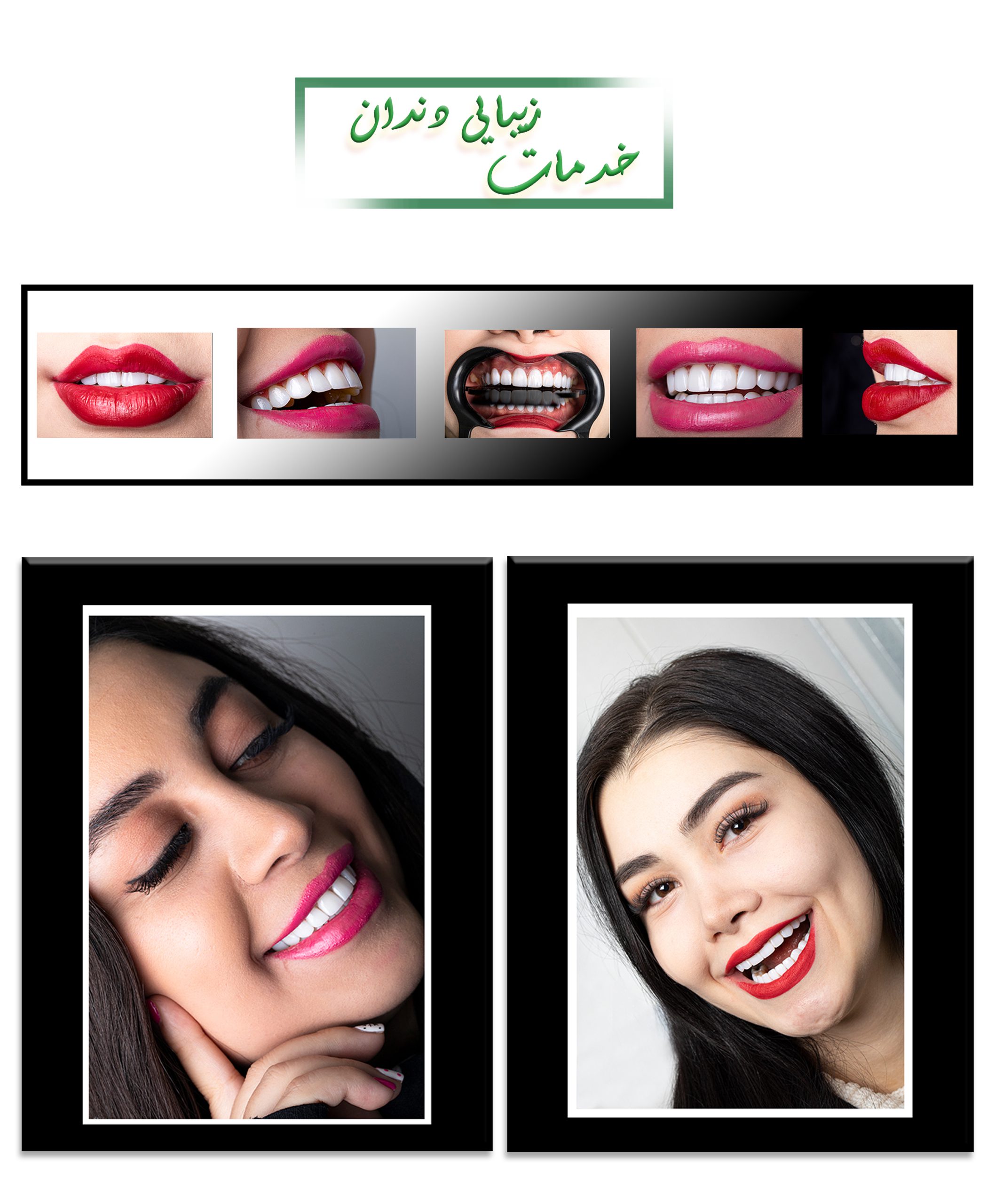 عکاسی تبلیغاتی از خدمات زیبایی دندان